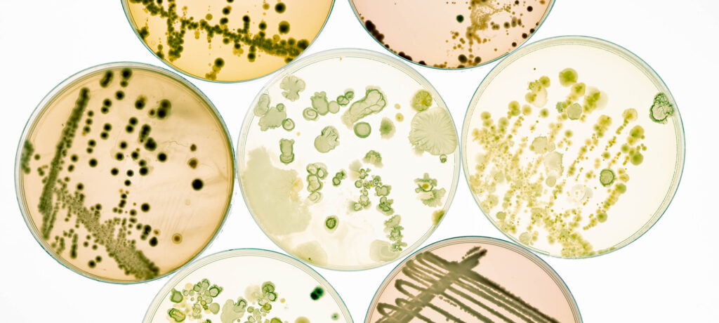 Many Petri dishes looking into occurrences of Microevolution and how they happen