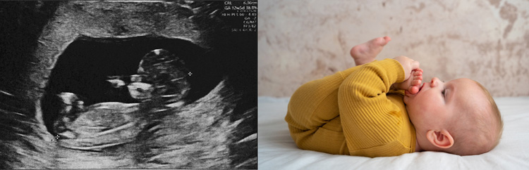 Side‑by‑side images showing an ultrasound scan of a developing human fetus next to a newborn lying on a soft surface, illustrating the Bible's assertion that life begins at conception.