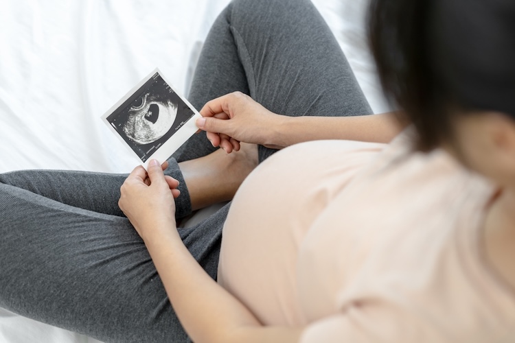 A pregnant woman sitting on a bed and holding a printed ultrasound image, illustrating early prenatal development in the broader context of discussions about what the Bible says about abortion.