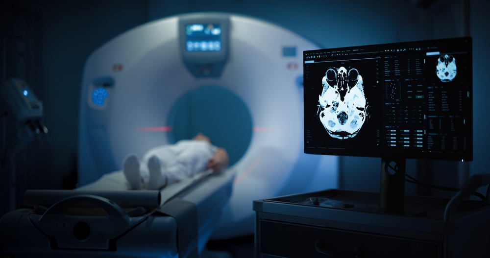 A patient undergoing a CT scan of their brain, with a scanned image of the human brain displayed on a monitor in the foreground.