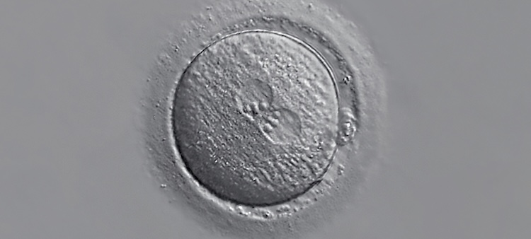 Human zygote at the one-cell stage with two visible pronuclei, illustrating early human development in the context of the virgin birth of Jesus.